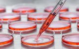 Several rows of cell culture dishes filled with a red liquid are lined up on a table. A dropper drops red liquid into one.